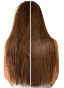 انواع تراپی مو و مقایسه آن ها با یکدیگر